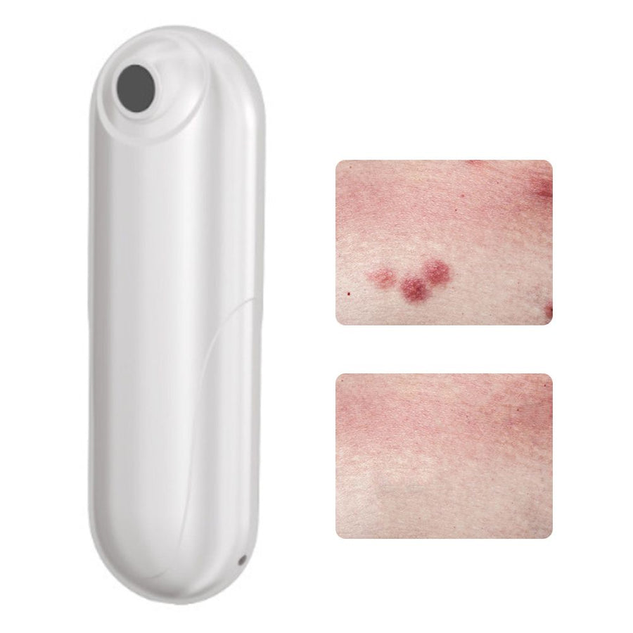 Bug Bite Itch Relief Tool USB Rechargeable Mosquito Bite Sucker Chemical Free for Bug Bites Bee Wasp Stings